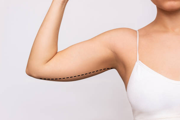 How Much Does It Cost To Remove Flabby Arms?