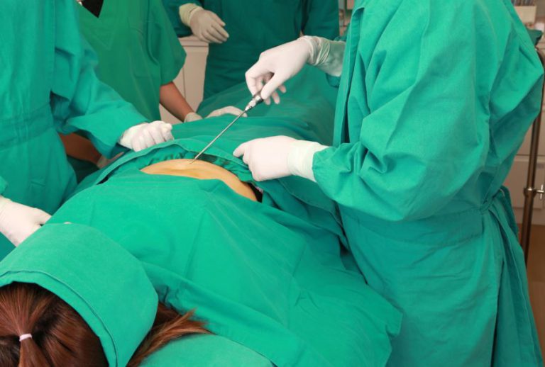 How Much Does Liposuction Cost In The UK