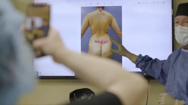 How Much Is A Brazilian Butt Lift?